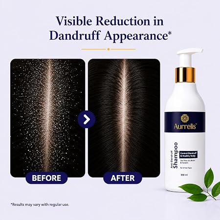 Aurrelis Arctic Scalp Anti-Dandruff Shampoo 300ml with piroctone olamine, keratin, biotin, and tea tree oil for healthy hair.