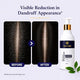 Aurrelis Arctic Scalp Anti-Dandruff Shampoo 300ml with piroctone olamine, keratin, biotin, and tea tree oil for healthy hair.