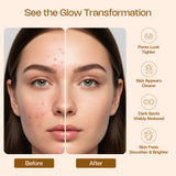 Aurrelis Rice Water Face Toner - 100ml | Pore Tightening, Hydrating & Brightening Toner