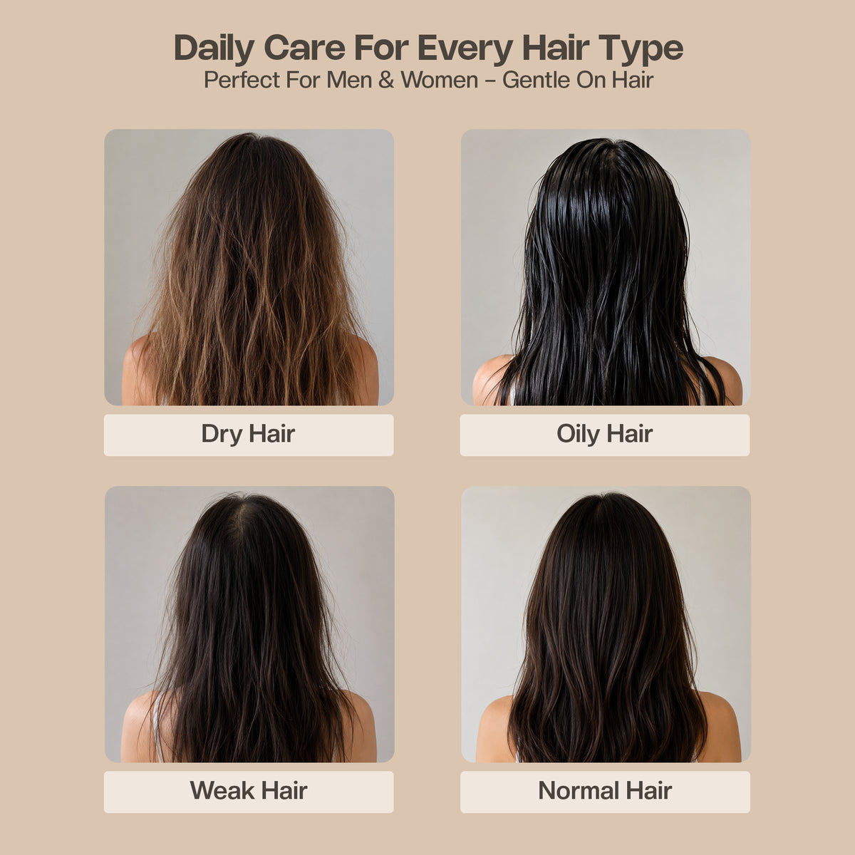 Aurrelis Batana Oil Conditioner for Dry & Frizzy Hair – Deep Nourishing Hair Conditioner with Coconut Milk, Keratin & Panthenol, 300ml